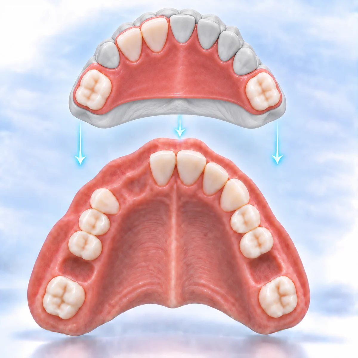 Pink acrylic partial denture shown fitted on a pale digital model, with a straight posterior border and close contours around every remaining tooth and interdental space
