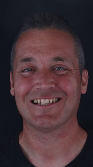 IMG_4945 IMG_4945